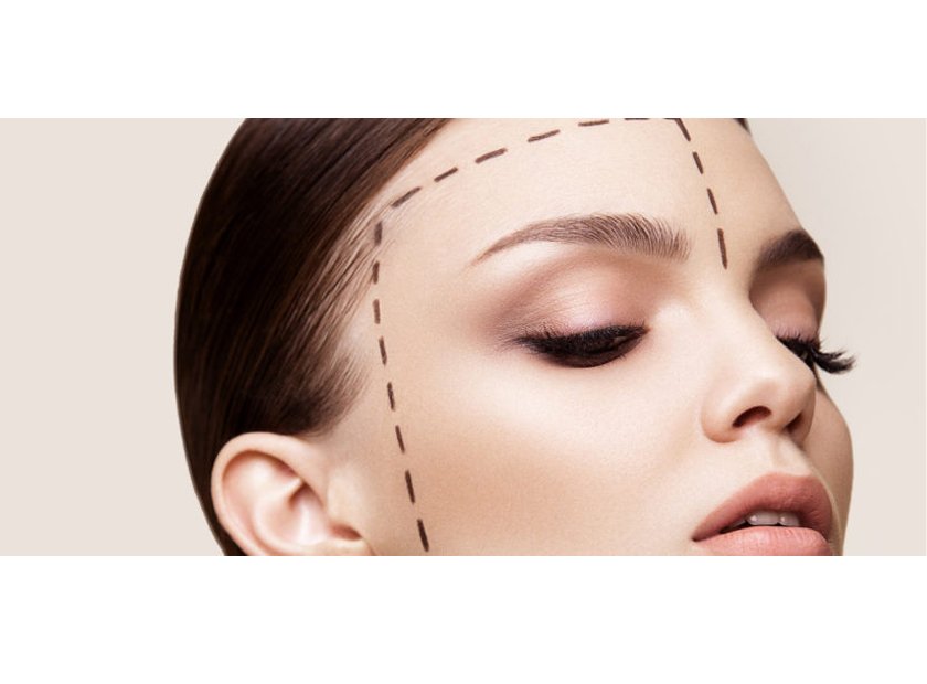 Non-surgical rhinoplasty ('nose job') case study
