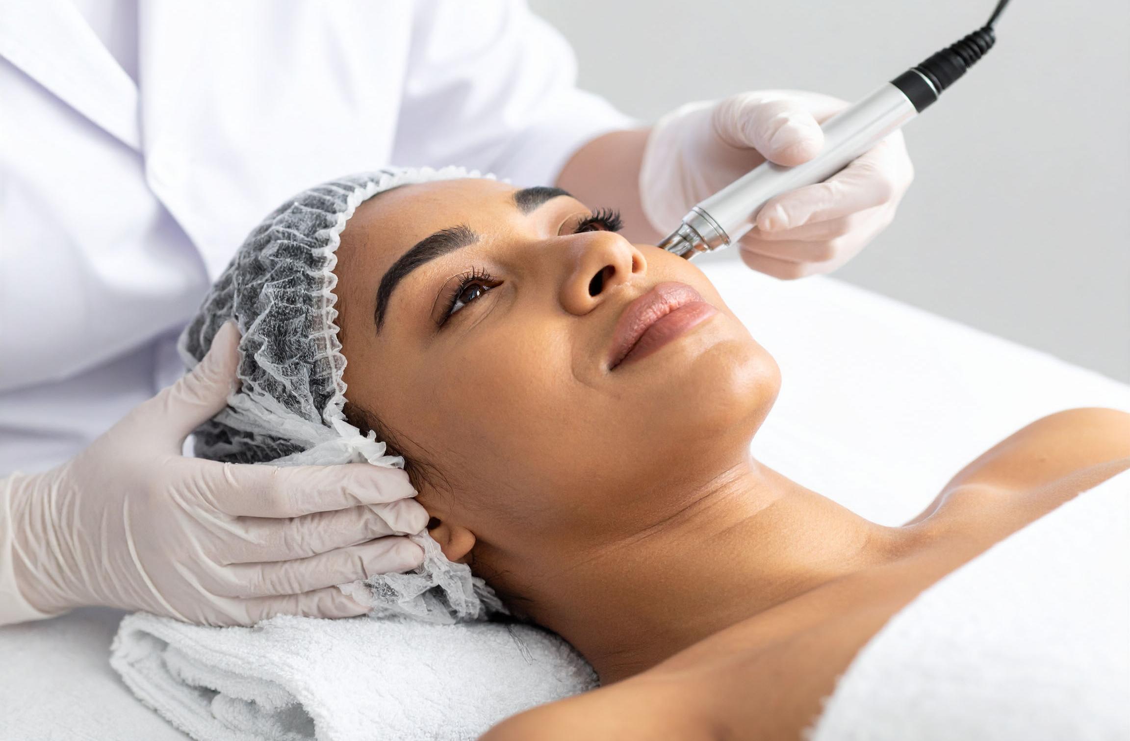a woman receiving microneedling treatment