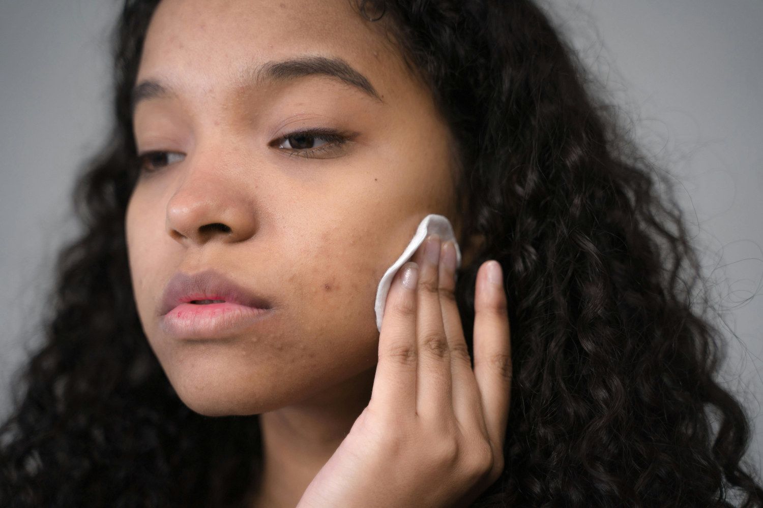 solutions-for-discolouration-and-dark-spots