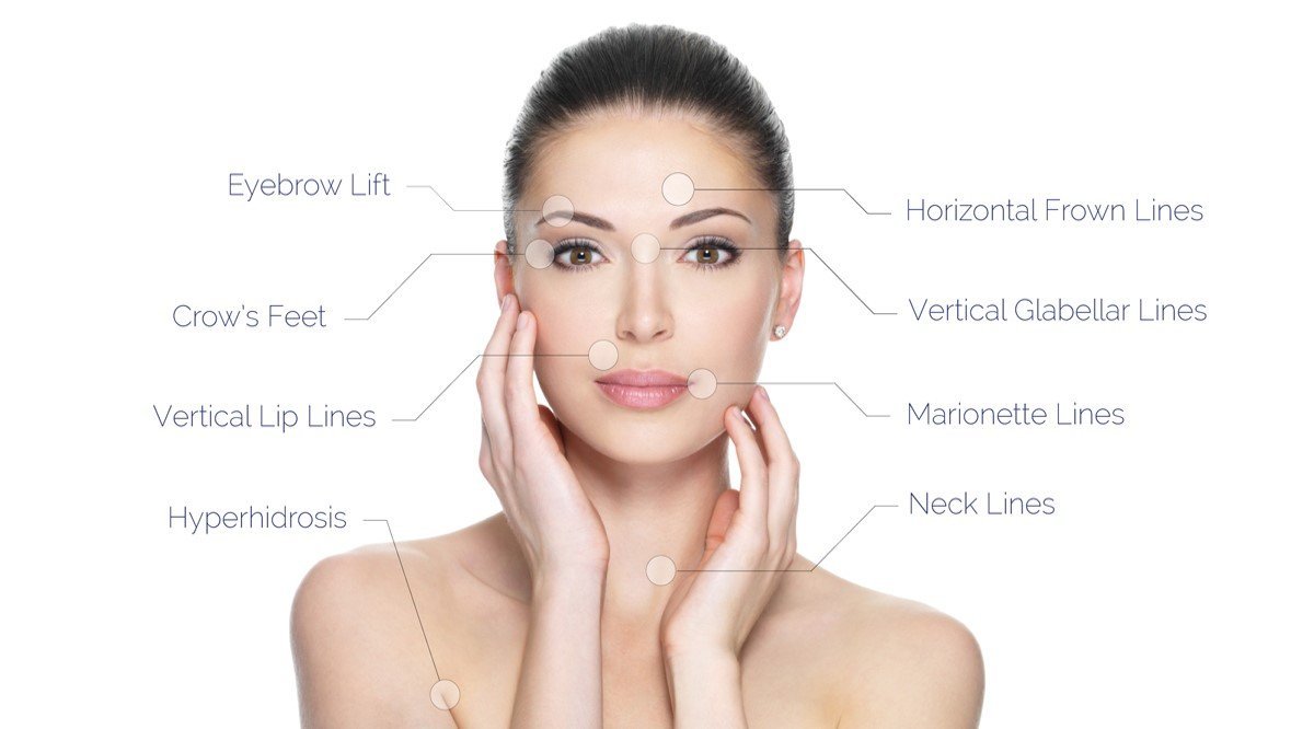 Laser Treatment for Wrinkles and Fine Lines Laser Treatment for Wrinkles and Fine Lines